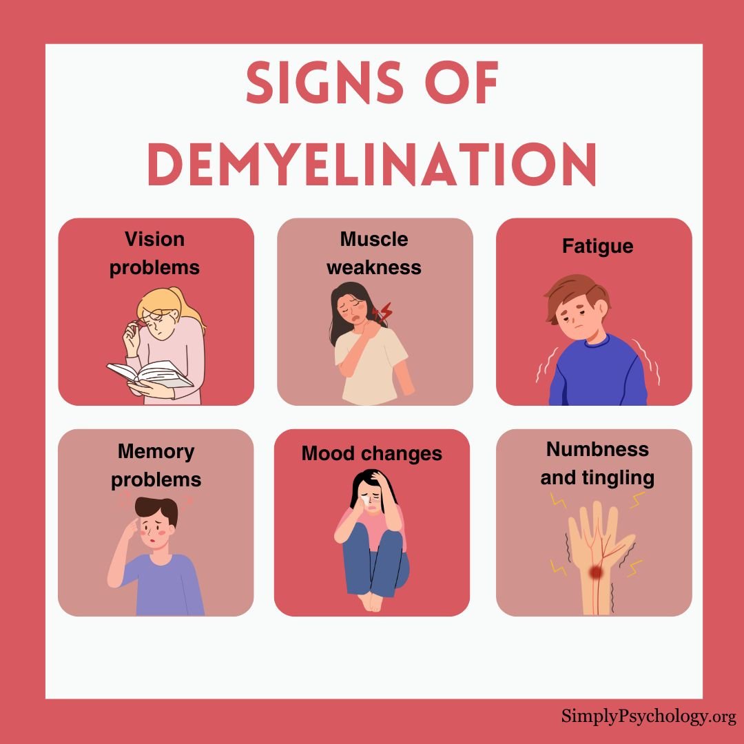 A 6-panel infographic titled "signs of demyelination" with some common signs such as vision problems, muscle weakness, and fatigue - associated images for each sign.