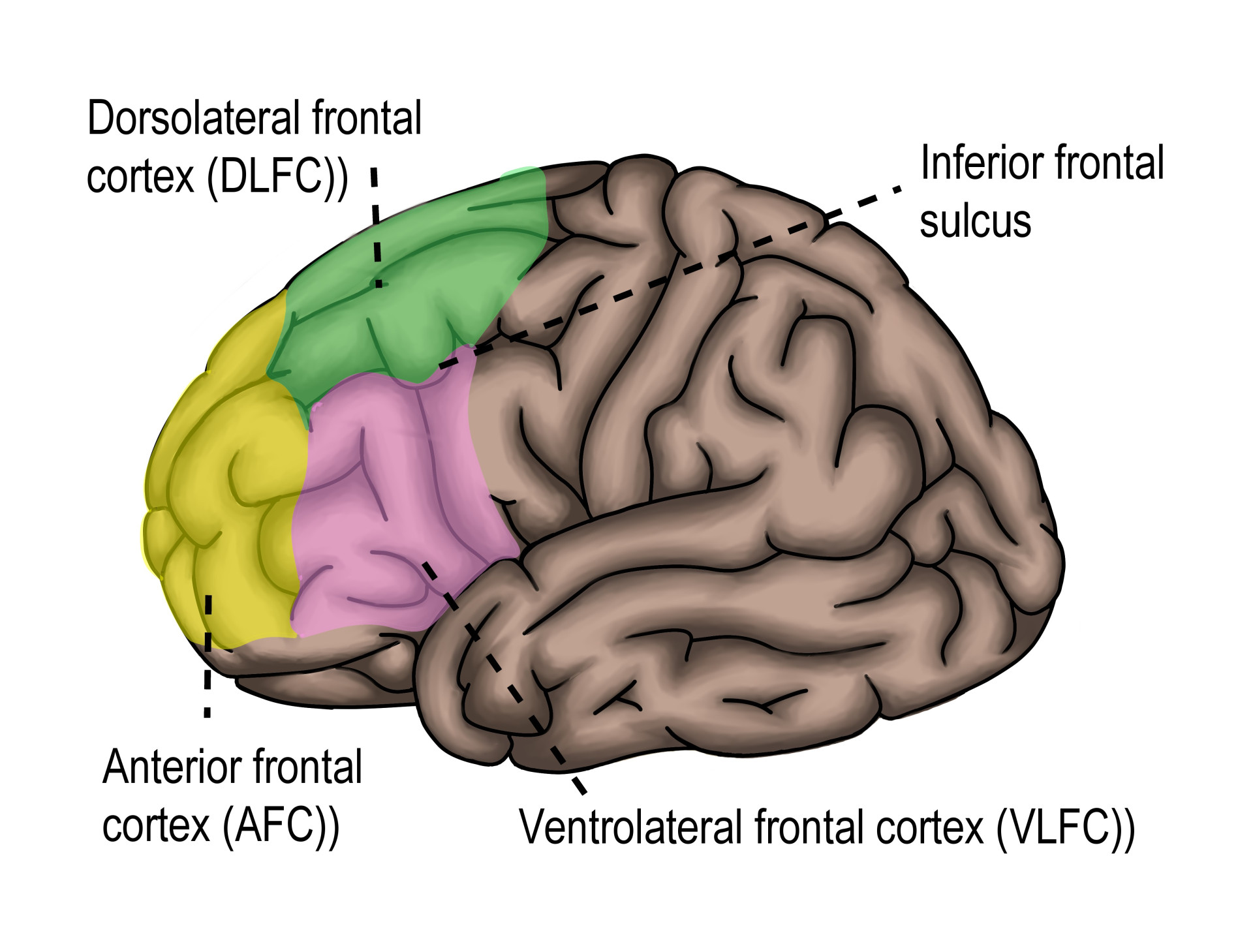 Dorsolateral Prefrontal Cortex diagram of the brain with the dorsolateral prefrontal cortex labelled.