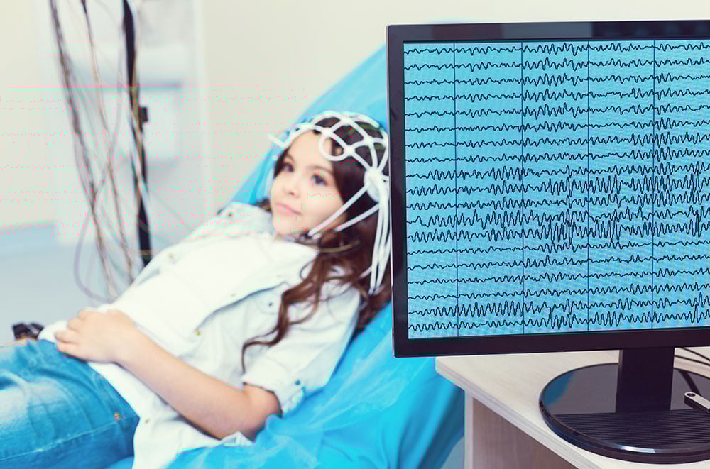 EEG Test (Electroencephalogram): Purpose, Procedure, and Risks 3 Electroencephalogram