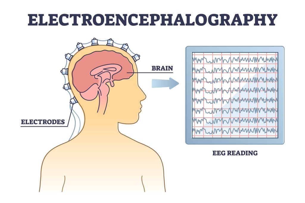 EEG Test (Electroencephalogram): Purpose, Procedure, and Risks 1 Electroencephalography EEG
