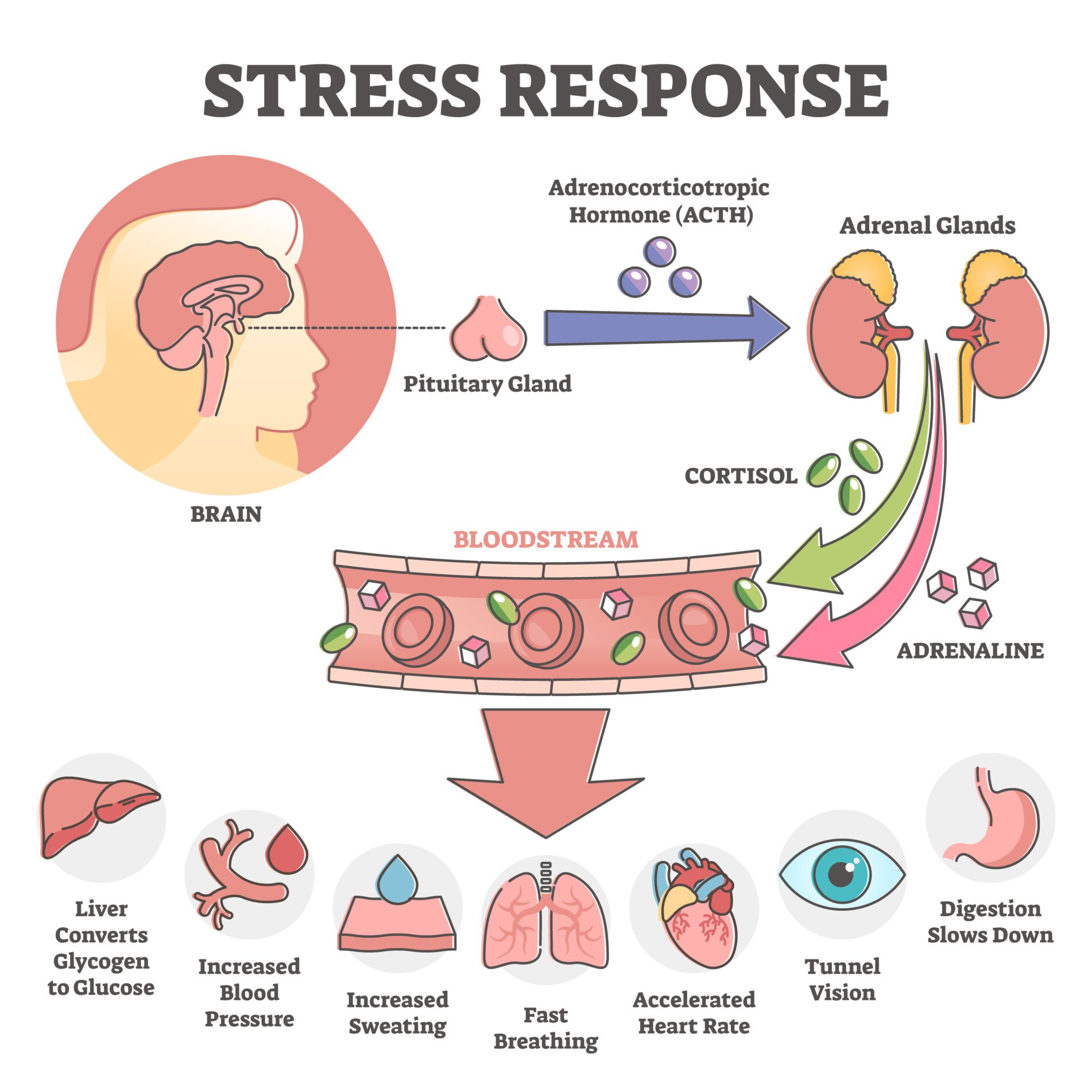 Stress Response Diagram of the stress response showing how the brain activates ACTH which causes cortisol and leads to physical reactions such as increased blood pressure and sweating