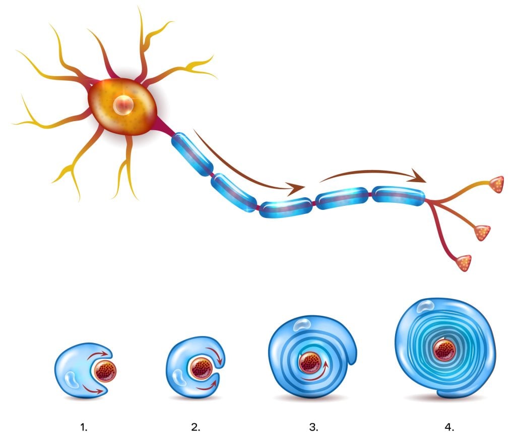 Myelin Sheath 3 Neuron with myelin sheath