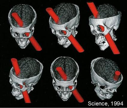 Phineas Gage
