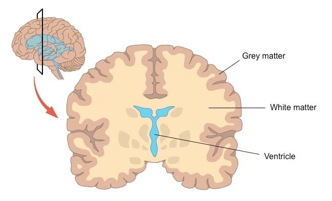 white-vs-grey-matter-2_med white vs grey matter 2 med